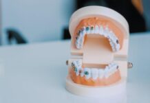 How Orthodontic Care Improves Your Smile and Confidence Orthodontic Care