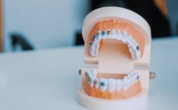 How Orthodontic Care Improves Your Smile and Confidence Orthodontic Care