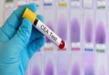 At-Home CEA Blood Tests: Convenience and Accuracy in Cancer Detection CEA Blood Tests