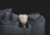 How To Find The Best Dental Implant Clinic Best Dental Implant Clinic