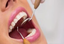 Lifestyle Choices and Their Impact on Dental Health Dental Health