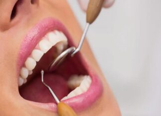 Lifestyle Choices and Their Impact on Dental Health Dental Health