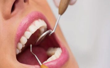 Lifestyle Choices and Their Impact on Dental Health Dental Health
