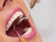 Lifestyle Choices and Their Impact on Dental Health Dental Health