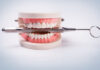 The Road to a Perfect Smile: All About Dental Implants Dental Implants