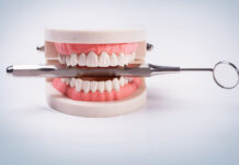 The Road to a Perfect Smile: All About Dental Implants Dental Implants