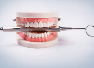 The Road to a Perfect Smile: All About Dental Implants Dental Implants
