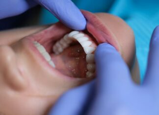 Dental Implants vs. Bridges: Which Option Is Best for Your Smile? Dental Implants vs. Bridges