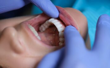 Dental Implants vs. Bridges: Which Option Is Best for Your Smile? Dental Implants vs. Bridges