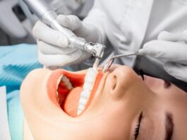 How Lifestyle Choices Can Damage or Cost You Your Teeth Healthy teeth