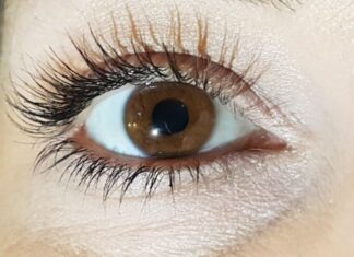 Is Glaucoma Hereditary? Understanding Your Risk Glaucoma Hereditary