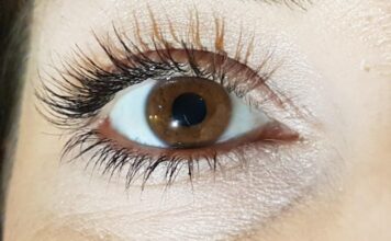 Is Glaucoma Hereditary? Understanding Your Risk Glaucoma Hereditary