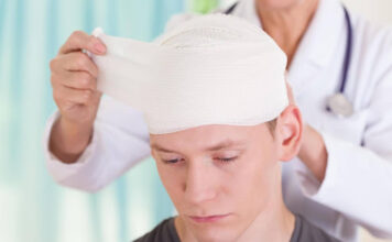 Maximizing Your Head Injury Settlement: 4 Tips From Experienced Attorneys Head Injury Settlement