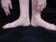 Leg pain, cold hands & feet may cause a disease