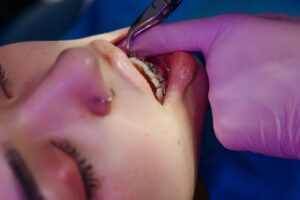 Orthodontic 1
