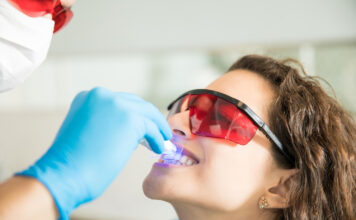 How Long Does Teeth Whitening Last_ And How To Make It Last Longer Teeth Whitening
