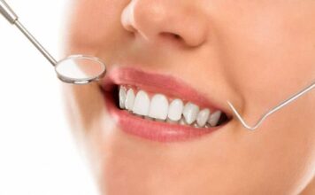 Why Choose Professional Teeth Whitening for a Brighter Smile Teeth Whitening