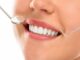 Why Choose Professional Teeth Whitening for a Brighter Smile Teeth Whitening