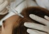 The Evolution and Technicalities of Follicular Unit Extraction: A Comprehensive Insight Follicular Unit Extraction