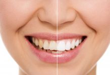 What Are The Techniques Used In Cosmetic Dentistry