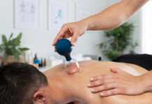 What is cupping? What is cupping