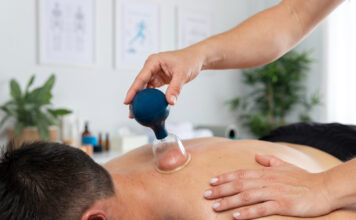 What is cupping? What is cupping