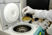 Benefits of Using a Microplate Washer in the Lab Microplate Washer