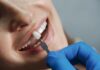 The Art of Smile Transformation: Teeth Bonding Techniques and Benefits Smile Transformation