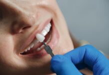 The Art of Smile Transformation: Teeth Bonding Techniques and Benefits Smile Transformation