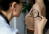 Why Should You Get a Skin Cancer Check? Skin Cancer