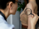 Why Should You Get a Skin Cancer Check? Skin Cancer