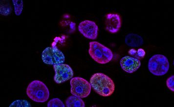 Types of Cancers and Misdiagnosis