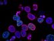 Types of Cancers and Misdiagnosis