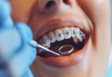 What an Orthodontist Can Do for Your Smile Orthodontist Smile