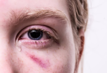 The Most Common Personal Injury Claims and How to Avoid Them Personal Injury